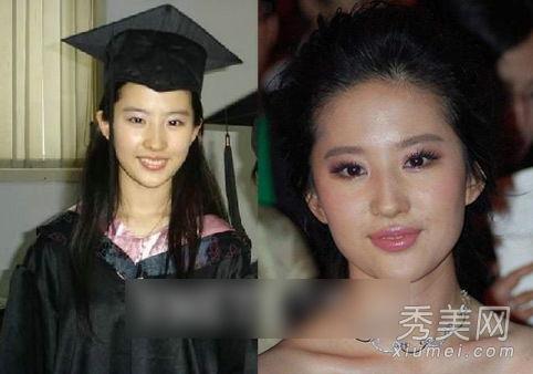 明星爆料整容视频大全最新,明星整容真相大曝光，视频大全揭秘美丽背后的秘密  第2张