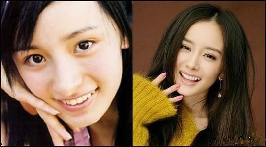 明星爆料整容视频大全最新,明星整容真相大曝光，视频大全揭秘美丽背后的秘密  第3张