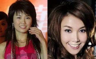 爆料娱乐圈明星整容,揭秘明星变脸背后的秘密  第2张