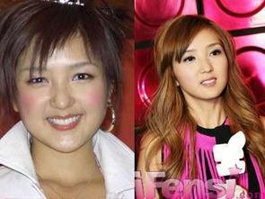 爆料娱乐圈明星整容,揭秘明星变脸背后的秘密  第3张